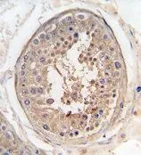 IHC-P analysis of human testis tissue using GTX81547 JLP antibody, Internal. IHC-P analysis of human testis tissue using GTX81547 JLP antibody, Internal.