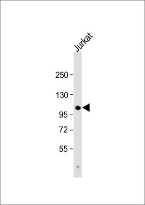 WB analysis of Jurkat whole cell lysate using GTX81550 PARG antibody, C-term. Loading : 20 microg per lane Dilution : 1:1000