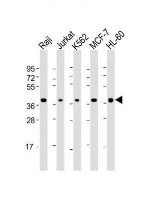 WB analysis of various samples using GTX81602 CD62L antibody, C-term. Lane 1: Raji whole cell lysate Lane 2: Jurkat whole cell lysate Lane 3: K562 whole cell lysate Lane 4: MCF-7 whole cell lysate Lane 5: HL-60 whole cell lysate Loading : 20 microg per lane Dilution : 1:2000