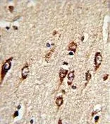 IHC-P analysis of human brain tissue using GTX81638 HEXA antibody, N-term. IHC-P analysis of human brain tissue using GTX81638 HEXA antibody, N-term.