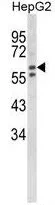 WB analysis of HepG2 cell lysate (35ug/lane) using GTX81638 HEXA antibody, N-term.
