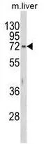 WB analysis of mouse liver tissue lysate (35ug/lane) using GTX81638 HEXA antibody, N-term.