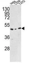 WB analysis of HeLa, CEM, T47D cell lysate (35ug/lane) using GTX81642 C9orf156 antibody, C-term.