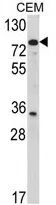 WB analysis of CEM cell lysate (35ug/lane) using GTX81652 TGM4 antibody, Internal.