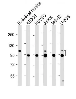 WB analysis of various samples using GTX81660 COMP antibody, Internal. Lane 1: Human skeletal muslce lysate Lane 2: ATDC5 whole cell lysate Lane 3: HUVEC whole cell lysate Lane 4: Jurkat whole cell lysate Lane 5: MG-63 whole cell lysate Lane 6: U-2OS whole cell lysate Loading : 20 microg per lane Dilution : 1:2000