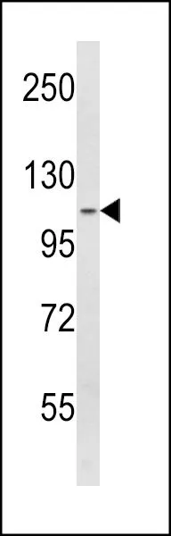 IHC-P analysis of human tonsil using GTX81680 SPINK5 antibody,N-term.
