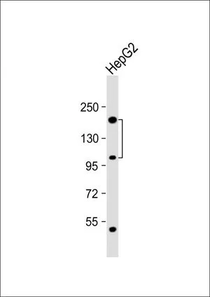 WB analysis of HepG2 whole cell lysate using GTX81681 CORIN antibody, Internal. Loading : 20 microg per lane Dilution : 1:1000 WB analysis of HepG2 whole cell lysate using GTX81681 CORIN antibody, Internal. Loading : 20 microg per lane Dilution : 1:1000