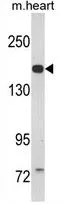 WB analysis of mouse heart tissue lysate (35ug/lane) using GTX81681 CORIN antibody, Internal.