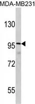 WB analysis of MDA-MB231 cell lysate (35ug/lane) using GTX81689 DLGAP1 antibody, N-term. WB analysis of MDA-MB231 cell lysate (35ug/lane) using GTX81689 DLGAP1 antibody, N-term.