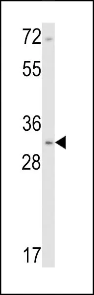WB analysis of NCI-H460 cell lysate (35ug/lane) using GTX81714 Calponin-1 antibody, N-term.