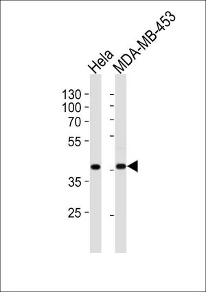 WB analysis of HeLa, MDA-MB-453 cell using GTX81714 Calponin-1 antibody, N-term. Loading : 20ug per lane Dilution : 1:1000