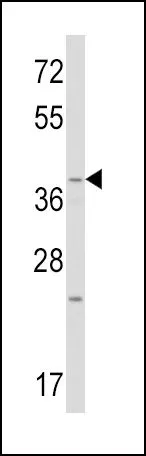 WB analysis of mouse heart tissue lysate (35ug/lane) using GTX81721 Wnt1 antibody, C-term.