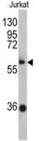 WB analysis of Jurkat cell lysate (35ug/lane) using GTX81742 ZBTB2 antibody, C-term.