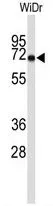 WB analysis of WiDr cell lysate (35ug/lane) using GTX81747 TOM70 antibody, N-term.
