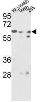 WB analysis of NCI-H460, HeLa, 293 cell lysate (35ug/lane) using GTX81833 GNS antibody, Internal.