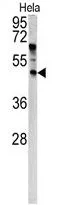 WB analysis of HeLa cell lysate (35ug/lane) using GTX81863 ANGPTL7 antibody, N-term.