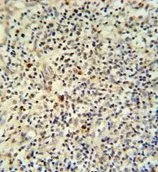 IHC-P analysis of human tonsil using GTX81877 FLI1 antibody, N-term. IHC-P analysis of human tonsil using GTX81877 FLI1 antibody, N-term.