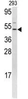 WB analysis of 293 cell lysate (35ug/lane) using GTX81877 FLI1 antibody, N-term.