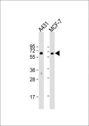 WB analysis of various samples using GTX81889 Paxillin antibody. Lane 1: A431 whole cell lysate Lane 2: MCF-7 whole cell lysate Loading : 20 microg per lane Dilution : 1:1000