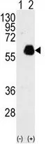 WB analysis of 293 cell lysate (2 ug/lane) either nontransfected (Lane 1) or transiently transfected with Paxillin (Lane 2) using GTX81889 Paxillin antibody.