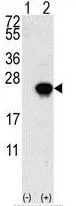 WB analysis of 293 cell lysate (2 ug/lane) either nontransfected (Lane 1) or transiently transfected with the FGF1 (Lane 2) using GTX81891 FGF1 antibody, N-term.