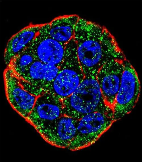 ICC/IF analysis of WiDr cells using GTX81891 FGF1 antibody, N-term. Green : FGF1 Red : Actin filament Blue : cell nucleus