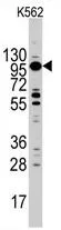 WB analysis of K562 cell lysate (35ug/lane) using GTX81898 Myosin 1C antibody, C-term.