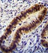 IHC-P analysis of human uterus tissue using GTX81906 Parp12 antibody, N-term. IHC-P analysis of human uterus tissue using GTX81906 Parp12 antibody, N-term.