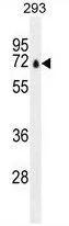 WB analysis of 293 cell lysate (35ug/lane) using GTX81906 Parp12 antibody, N-term.