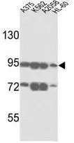 WB analysis of A375, K562, A2058 and HL-60 cell lysate (35ug/lane) using GTX81935 ABCB5 antibody, N-term. WB analysis of A375, K562, A2058 and HL-60 cell lysate (35ug/lane) using GTX81935 ABCB5 antibody, N-term.