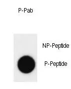 Dot Blot analysis of c-Abl phospho- or Non phospho-peptide using GTX81938 c-Abl (phospho Tyr412) Antibody. 50ng of Phospho-peptide or Non phospho-peptide per dot were adsorbed. Dilution : 0.5microg/ml