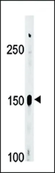 WB analysis of A2058 cell lysate (35ug/lane) using GTX81938 c-Abl (phospho Tyr412) Antibody.