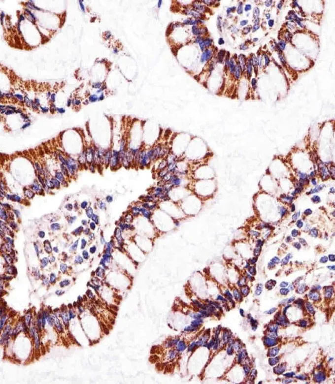 IHC-P analysis of human small intestine using GTX81939 ATP5B antibody, Internal. Dilution : 1:25