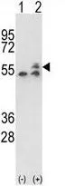 WB analysis of 293 cell lysate (2 ug/lane) either nontransfected (Lane 1) or transiently transfected with the ATP5B (Lane 2) using GTX81939 ATP5B antibody, Internal.