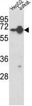 WB analysis of HepG2, Jurkat cell lysate (35ug/lane) using GTX81941 hnRNP L antibody, Internal.