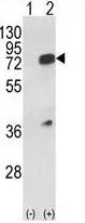 WB analysis of 293 cell lysate (2 ug/lane) either nontransfected (Lane 1) or transiently transfected with the hnRNP L (Lane 2) using GTX81941 hnRNP L antibody, Internal.