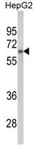 WB analysis of HepG2 cell lysate (35ug/lane) using GTX81942 hnRNP L antibody, C-term.