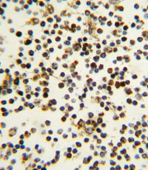 IHC-P analysis of human lymph tissue using GTX81996 Nucleophosmin antibody, N-term. IHC-P analysis of human lymph tissue using GTX81996 Nucleophosmin antibody, N-term.