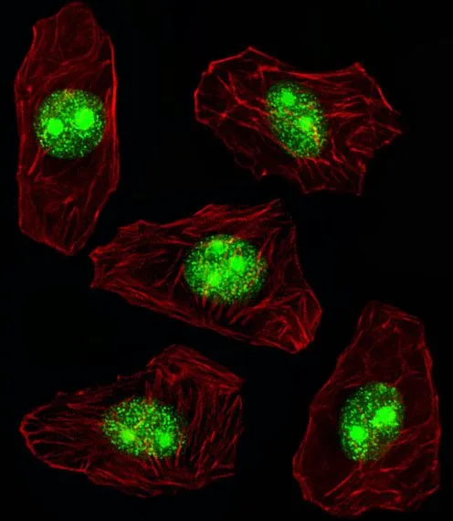 ICC/IF analysis of A549 cells using GTX81996 Nucleophosmin antibody, N-term. Green : Nucleophosmin Red : Actin filament Fixation : 4% paraformaldehyde (PFA) (20 min) Permeabilization : Triton X-100 (0.1%, 10 min) Dilution : 1:25