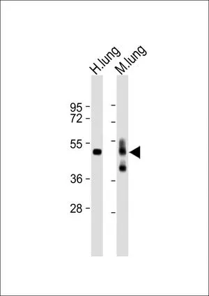 WB analysis of various samples using GTX82505 RAGE antibody, N-term. Lane 1: Human lung lysate Lane 2: Mouse lung lysate Loading : 20 microg per lane Dilution : 1:2000