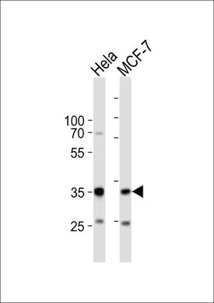 WB analysis of HeLa, MCF-7 cell using GTX82509 SNAI1 antibody, N-term. Loading : 20ug per lane Dilution : 1:1000 WB analysis of HeLa, MCF-7 cell using GTX82509 SNAI1 antibody, N-term. Loading : 20ug per lane Dilution : 1:1000