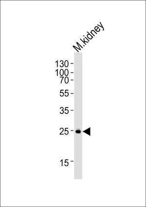 WB analysis of mouse kidney tissue lysate using GTX82509 SNAI1 antibody, N-term. Loading : 35ug per lane Dilution : 1:1000