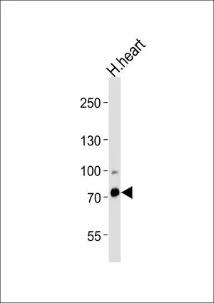 WB analysis of human heart tissue using GTX82519 ZNF219 antibody, N-term. Loading : 35ug Dilution : 1:1000