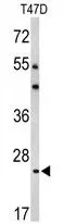 WB analysis of T47D cell lysate (35ug/lane) using GTX82541 Bcl2A1 antibody, Internal.