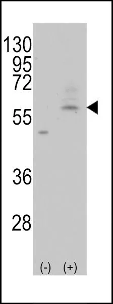 WB analysis of 293 cell lysate (2 ug/lane) either nontransfected (Lane 1) or transiently transfected with the PMAT(Slc29a4) (Lane 2) using GTX82546 PMAT (Slc29a4) antibody, C-term. WB analysis of 293 cell lysate (2 ug/lane) either nontransfected (Lane 1) or transiently transfected with the PMAT(Slc29a4) (Lane 2) using GTX82546 PMAT (Slc29a4) antibody, C-term.