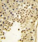 IHC-P analysis of human testis tissue using GTX82550 FBXL11 antibody, Internal. IHC-P analysis of human testis tissue using GTX82550 FBXL11 antibody, Internal.