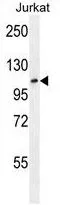 WB analysis of Jurkat cell lysate (35ug/lane) using GTX82550 FBXL11 antibody, Internal.