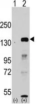 WB analysis of 293 cell lysate (2 ug/lane) either nontransfected (Lane 1) or transiently transfected with the JHDM1a/FBXL11 (Lane 2) using GTX82550 FBXL11 antibody, Internal.