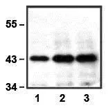 IP of anti-ERK1 using 50microg of Jurkat cell lysate; 0.5microg (1), 1microg (2), and 2microg (3) of anti-ERK1 used
