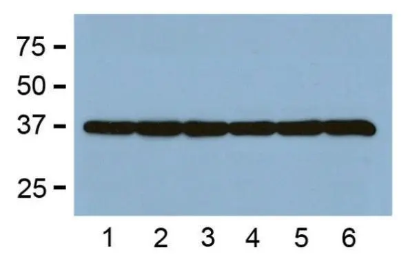 WB from BL-21 bacteria (1),Sf9 insect (2),and Saccharomyces cerevisiae (3)